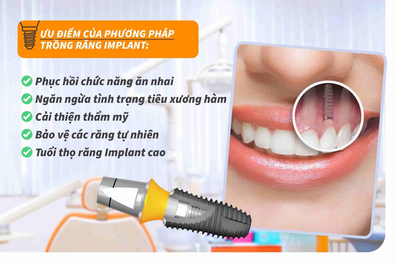 5 ưu điểm của phương pháp trồng răng Implant