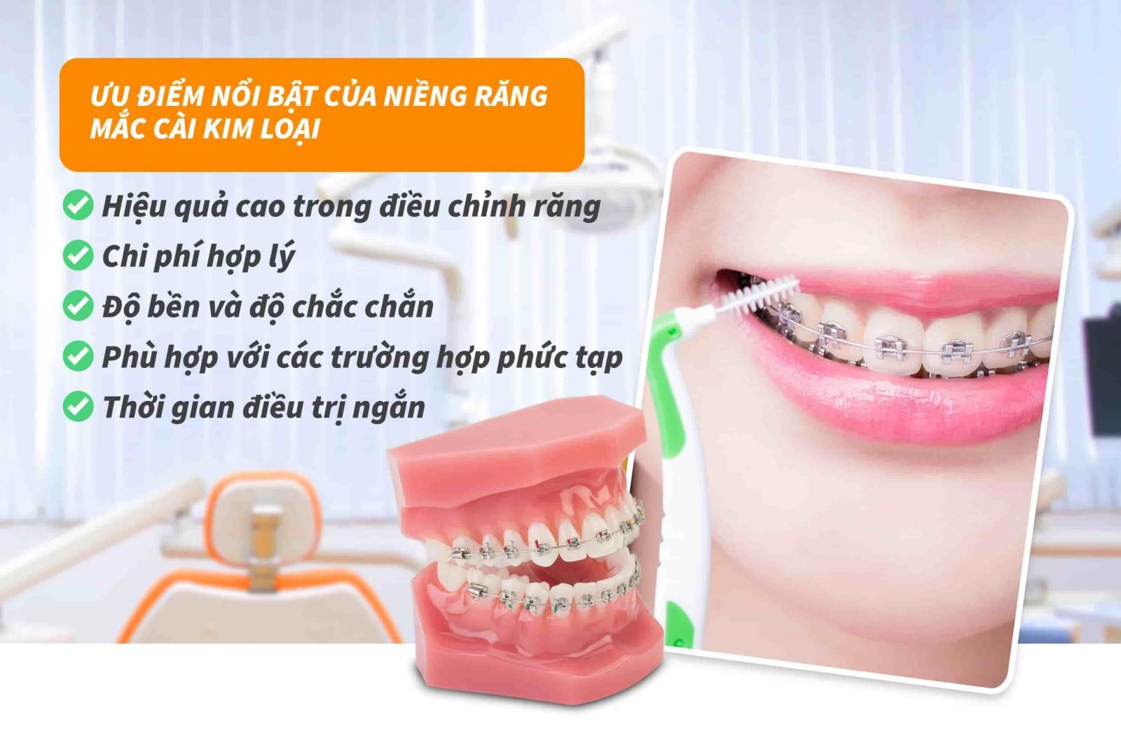 Ưu điểm của niềng răng mắc cài kim loại