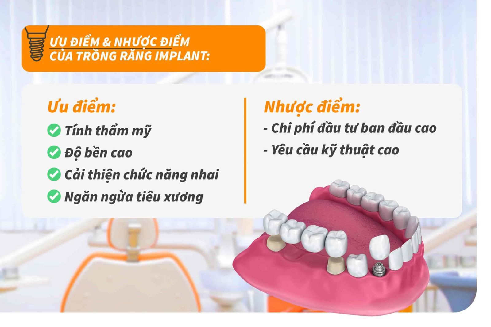 Ưu điểm và hạn chế của trồng răng Implant