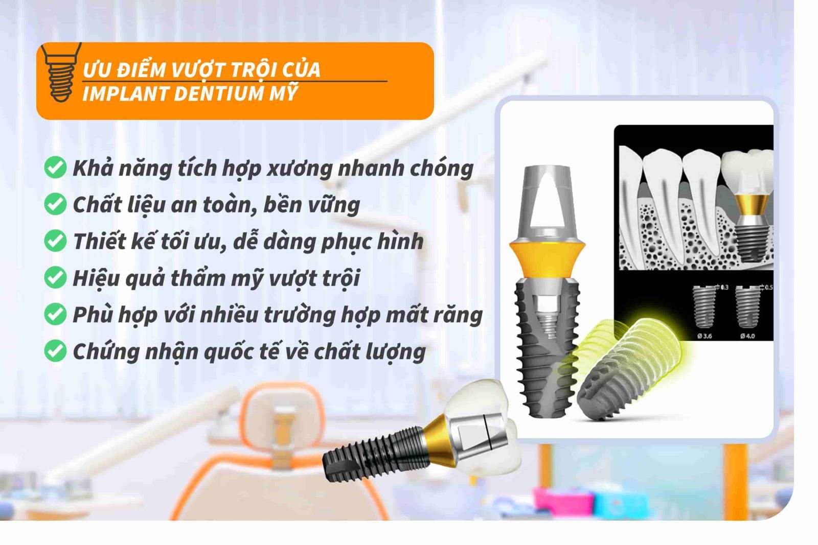 Ưu điểm vượt trội của Implant Dentium Mỹ