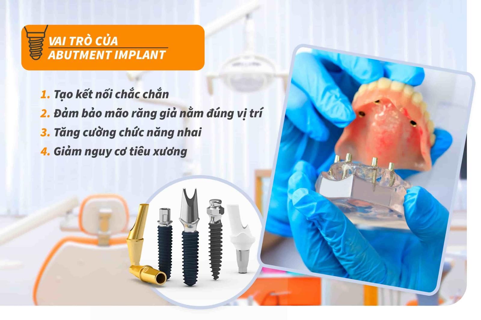 Vai trò của Abutment Implant