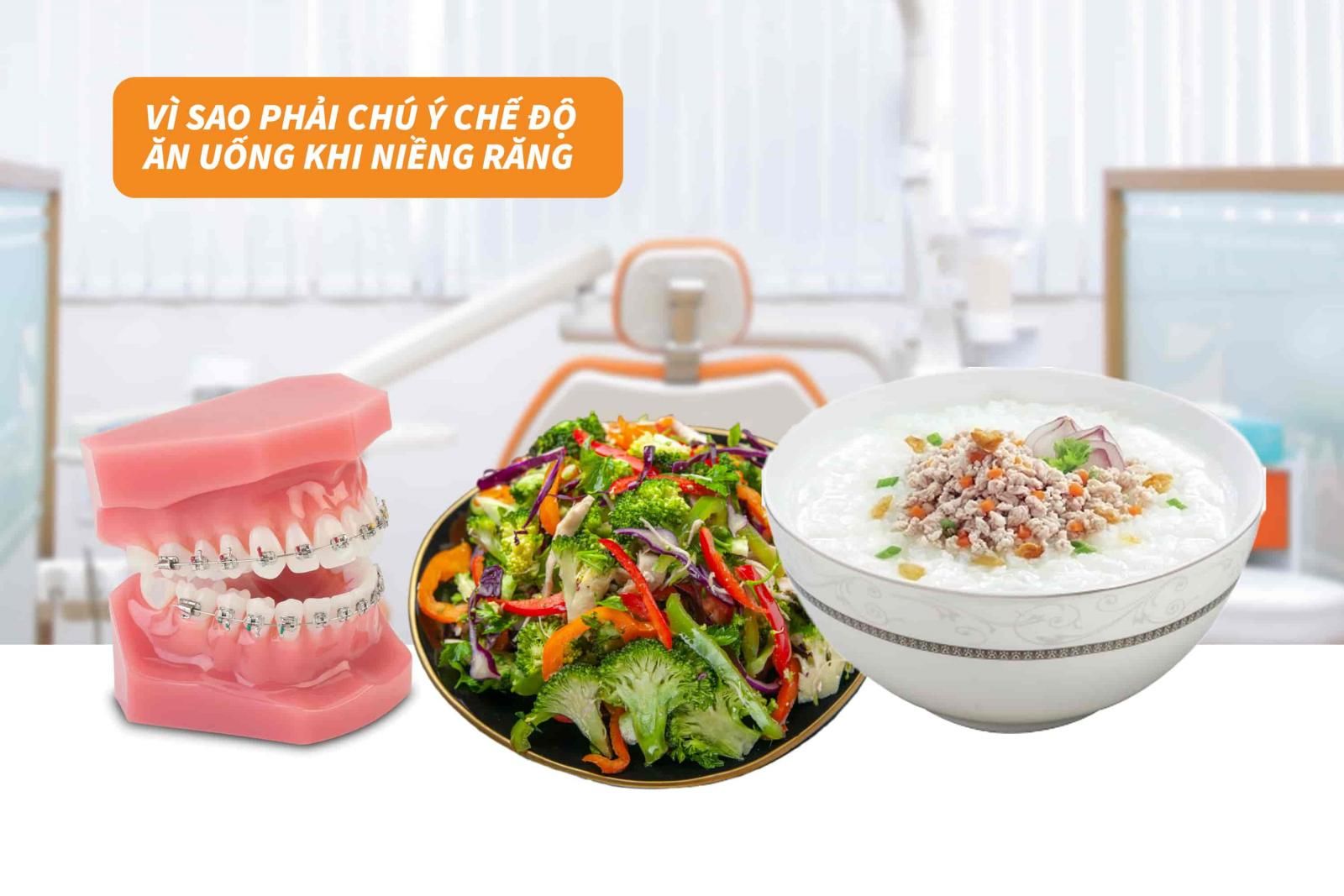 Vì sao phải chú ý chế độ ăn uống khi niềng răng