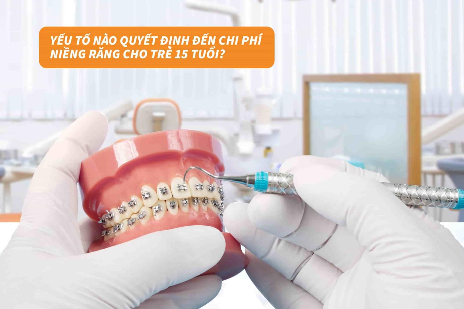 Yếu tố nào quyết định đến chi phí niềng răng cho trẻ 15 tuổi