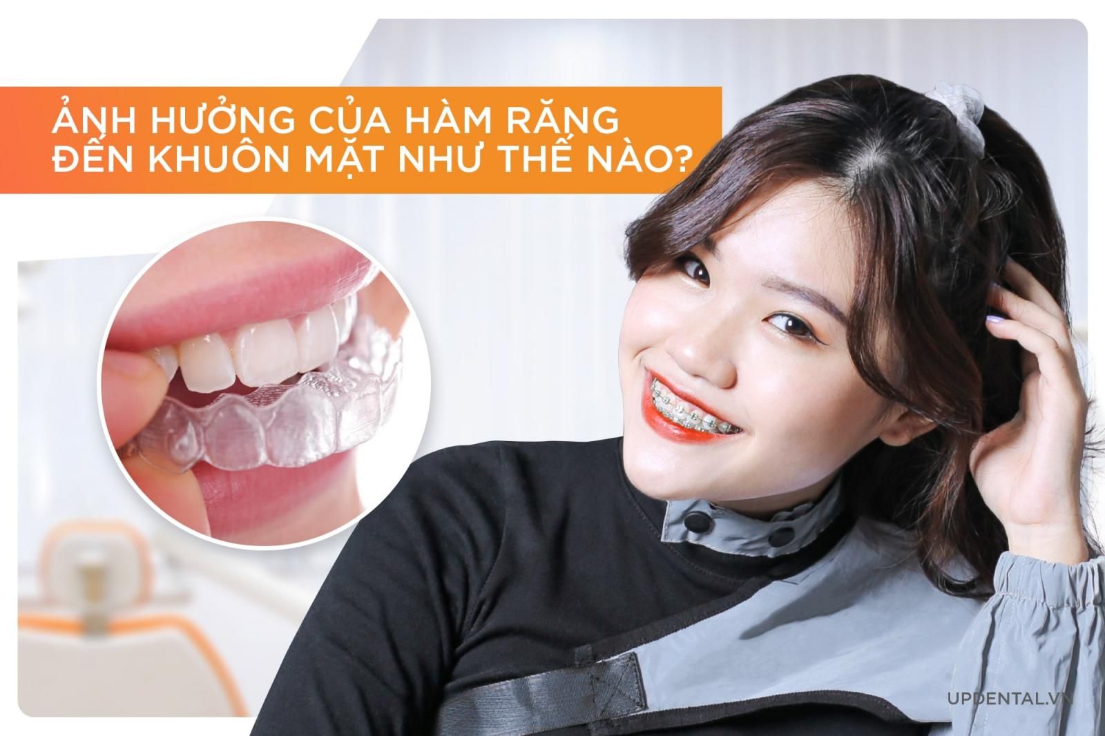 Ảnh hưởng của hàm răng đến khuôn mặt