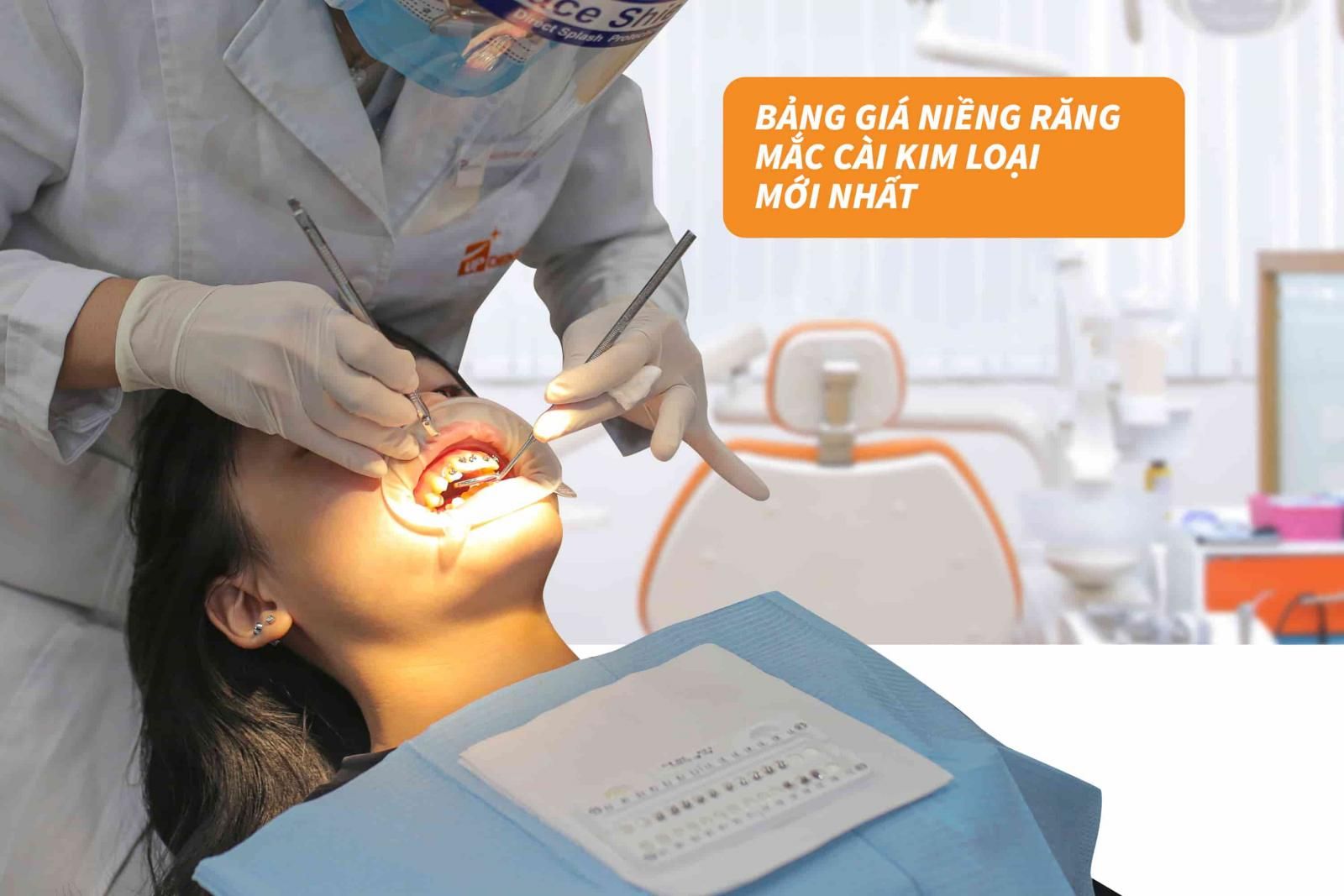 Bảng giá niềng răng mắc cài kim loại mới nhất 