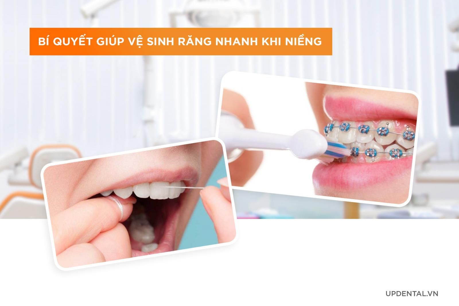 Bí quyết vệ sinh răng miệng sạch sẽ