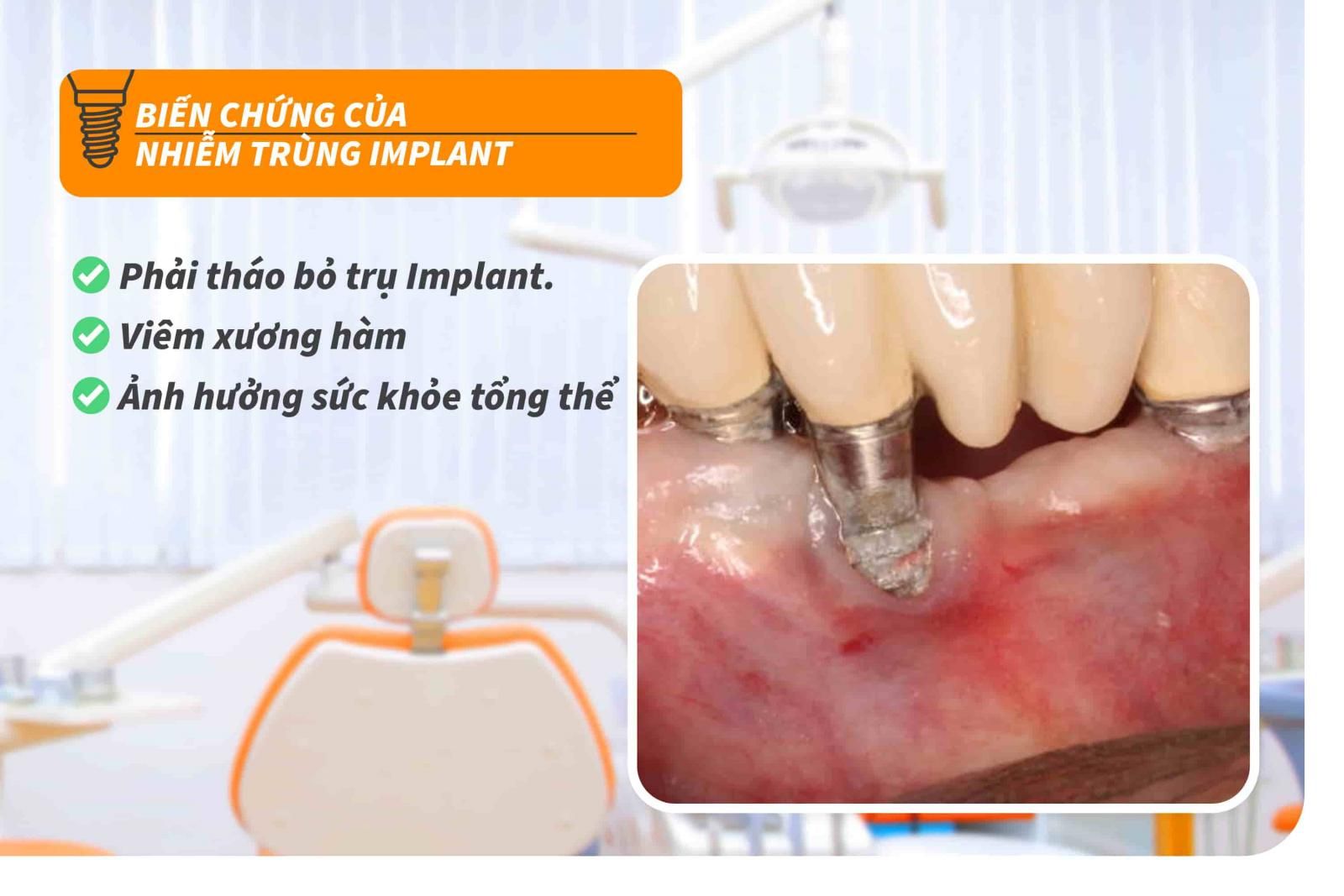 Các biến chứng của nhiễm trùng Implant