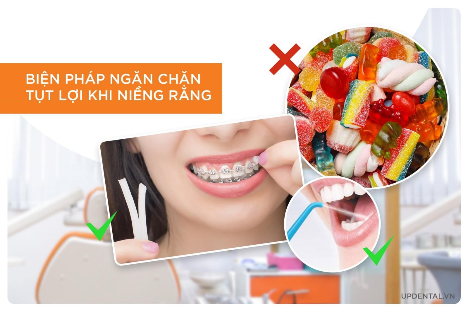 biện pháp phòng ngừa niềng răng bị tụt lợi