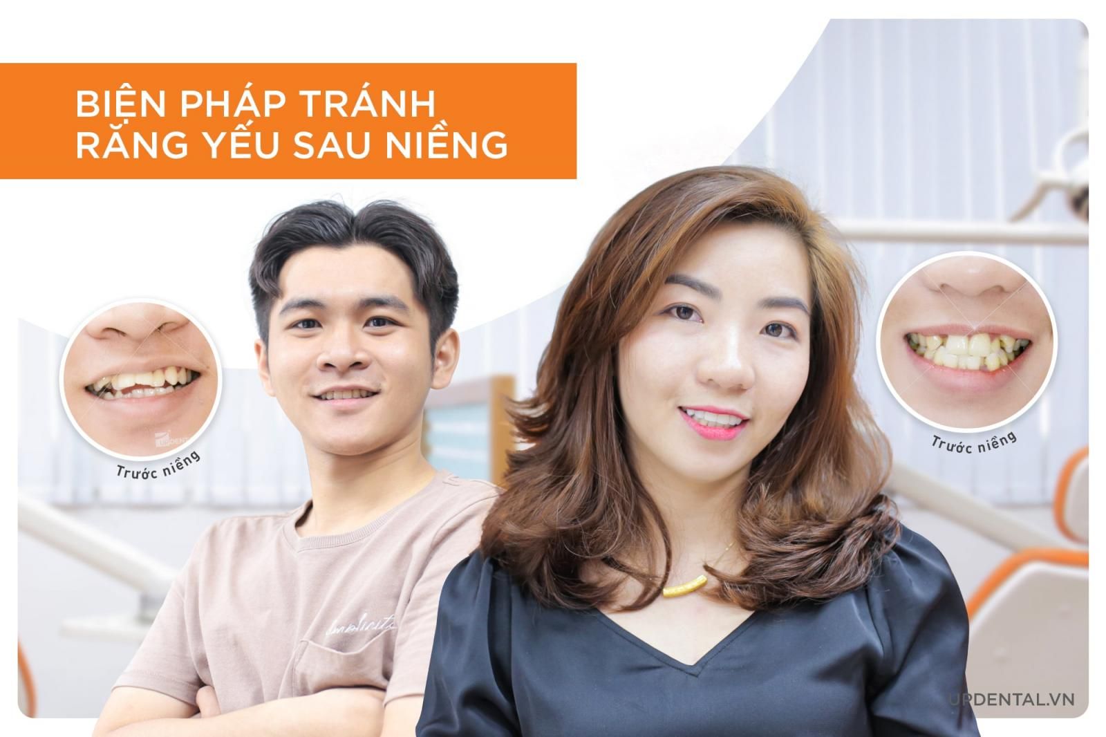 biện pháp phòng tránh răng yếu sau khi niềng