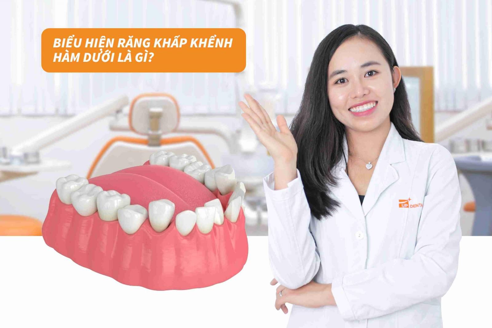 Biểu hiện răng khấp khểnh hàm dưới là gì