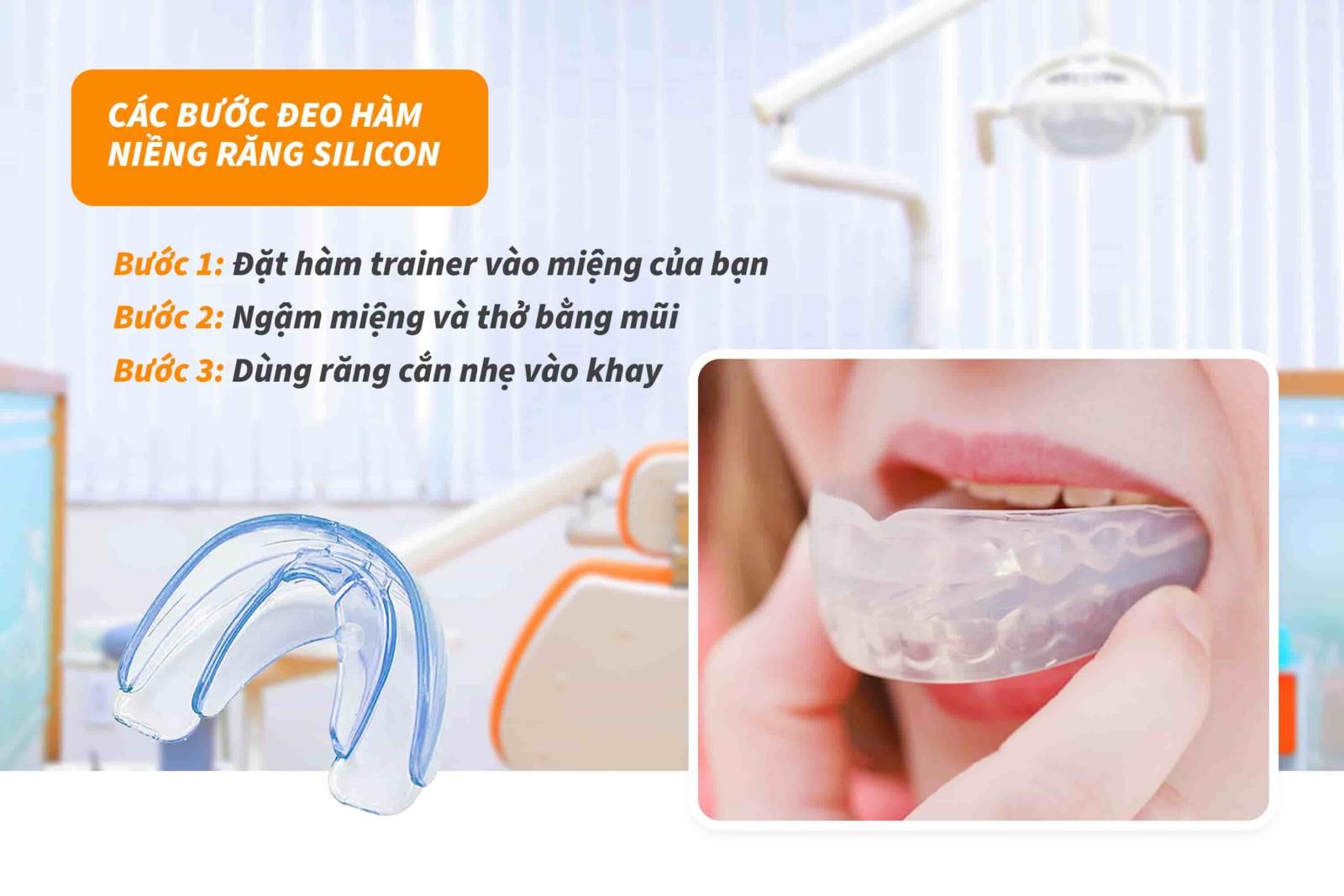 Hướng dẫn niềng răng silicon hiệu quả