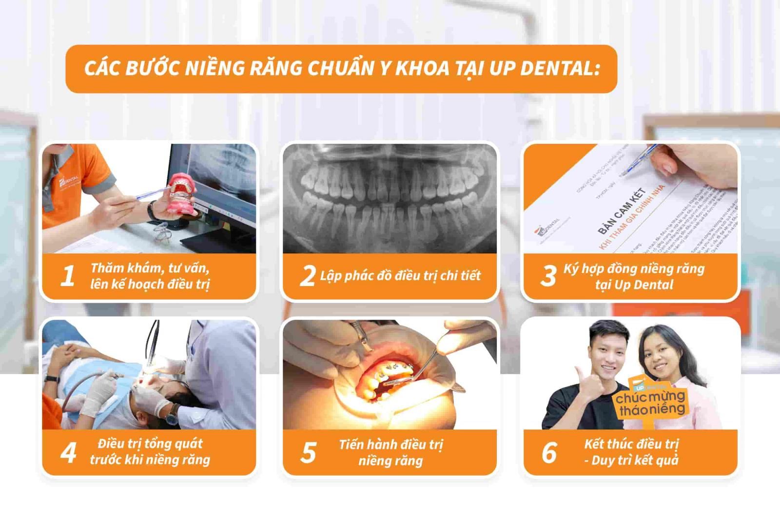 Tìm hiểu về niềng răng: Quy trình niềng răng mắc cài chuẩn Y khoa tại Up Dental