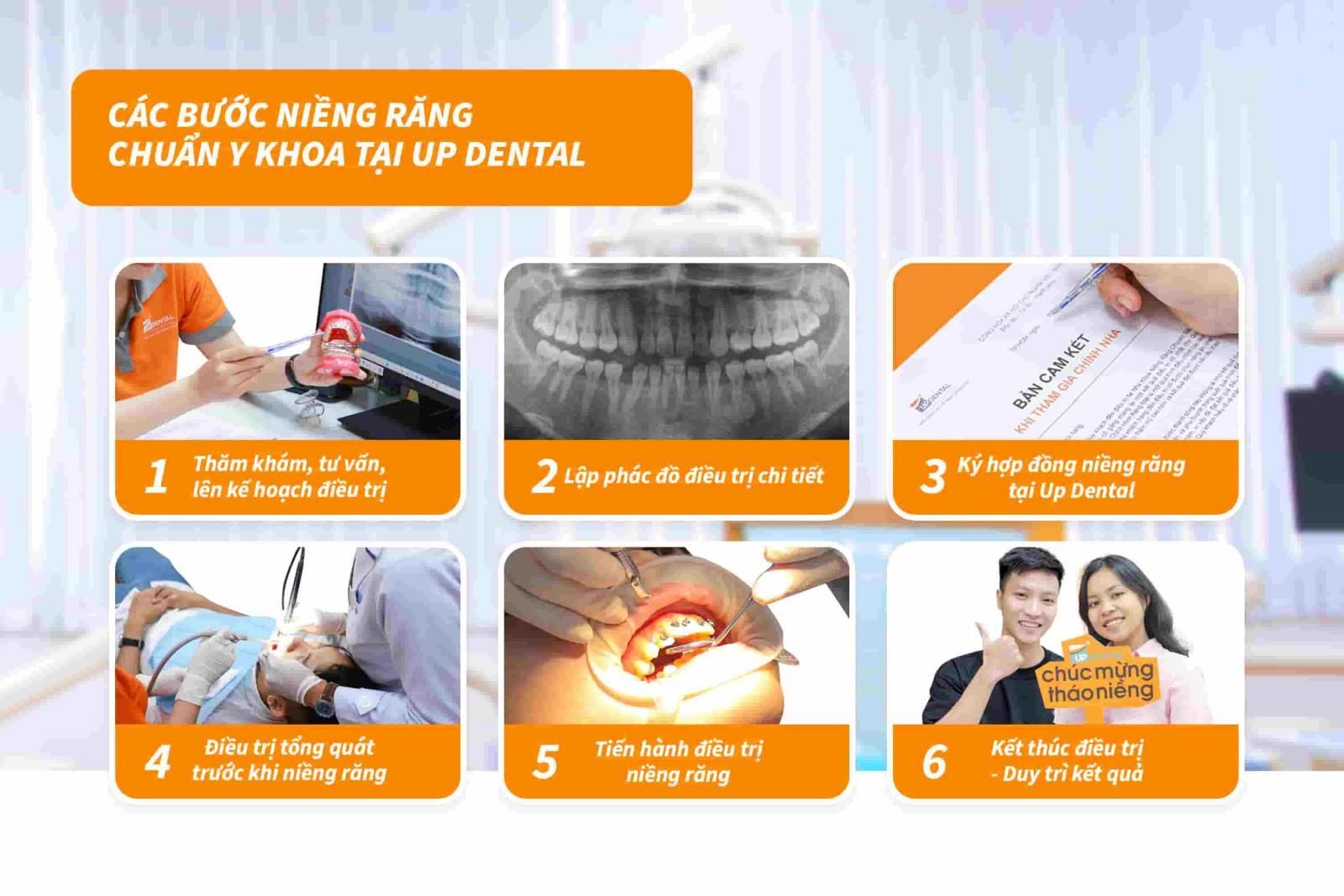 Quy trình niềng răng chuẩn Y khoa tại Up Dental