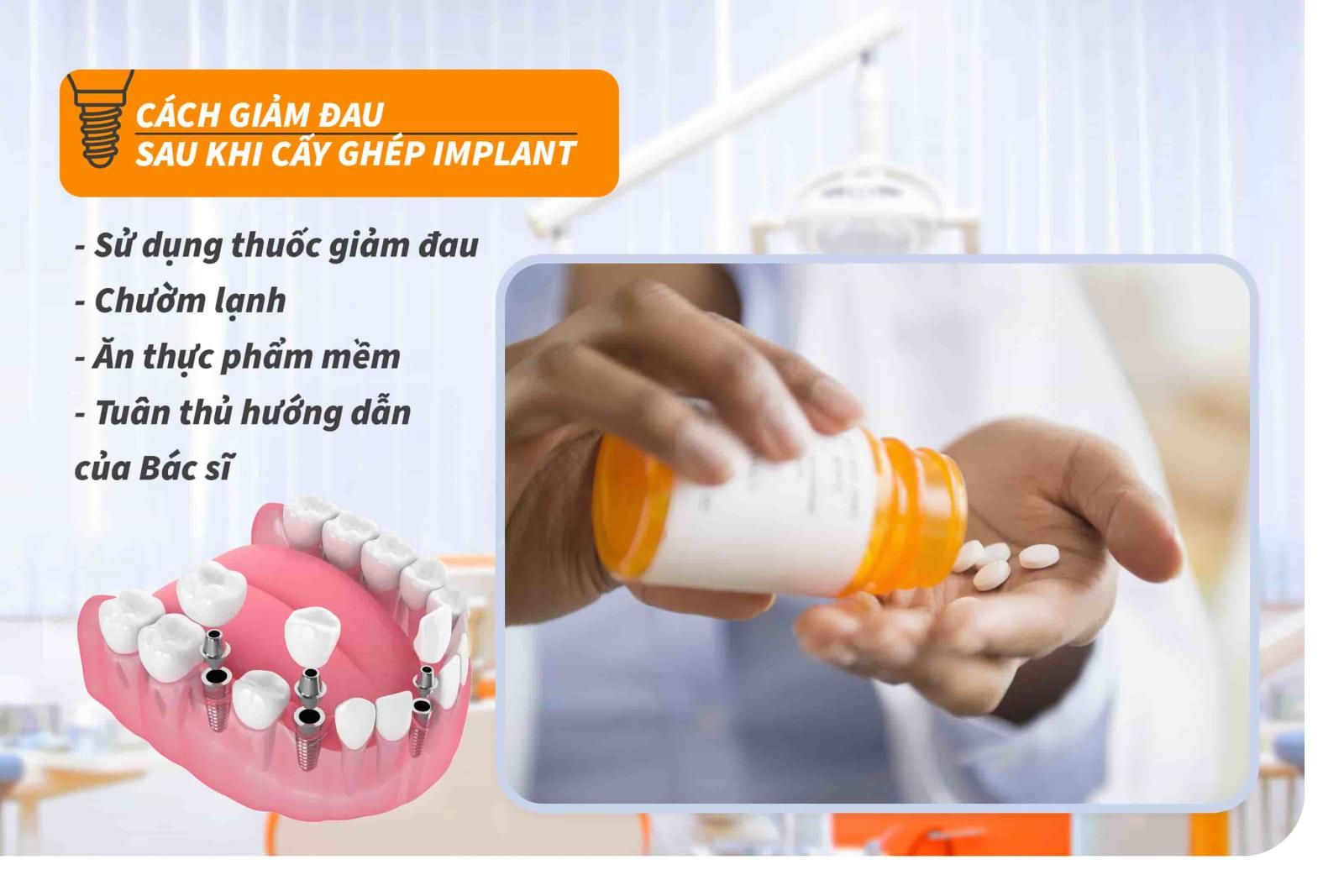 Cách giảm đau sau khi cấy ghép Implant