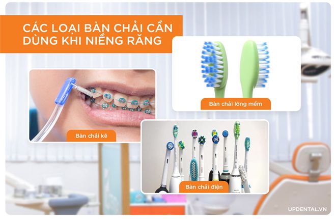 các loại bàn chải cần dùng khi niềng răng