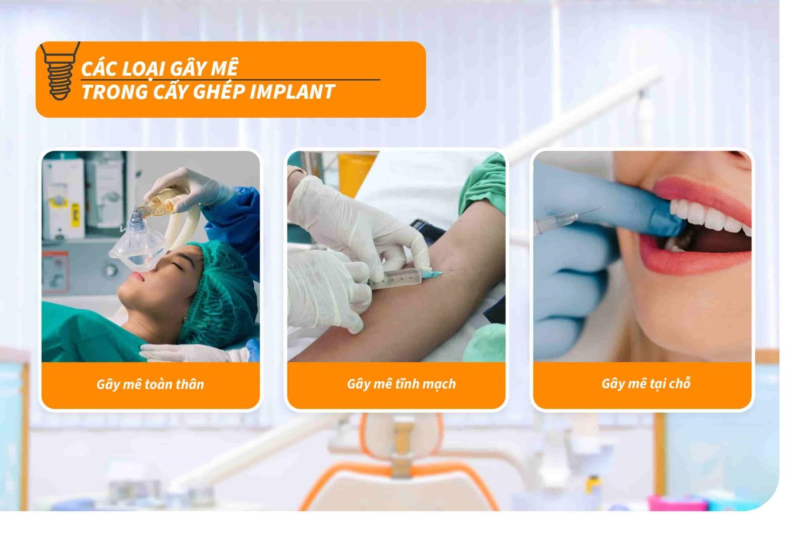 Các loại gây mê trong cấy ghép Implant