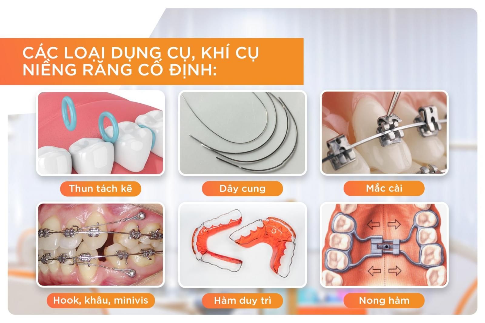 Các loại khí cụ niềng răng cố định