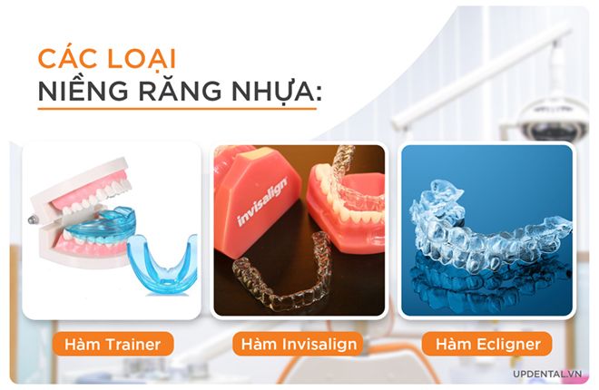 3 phương pháp niềng răng nhựa