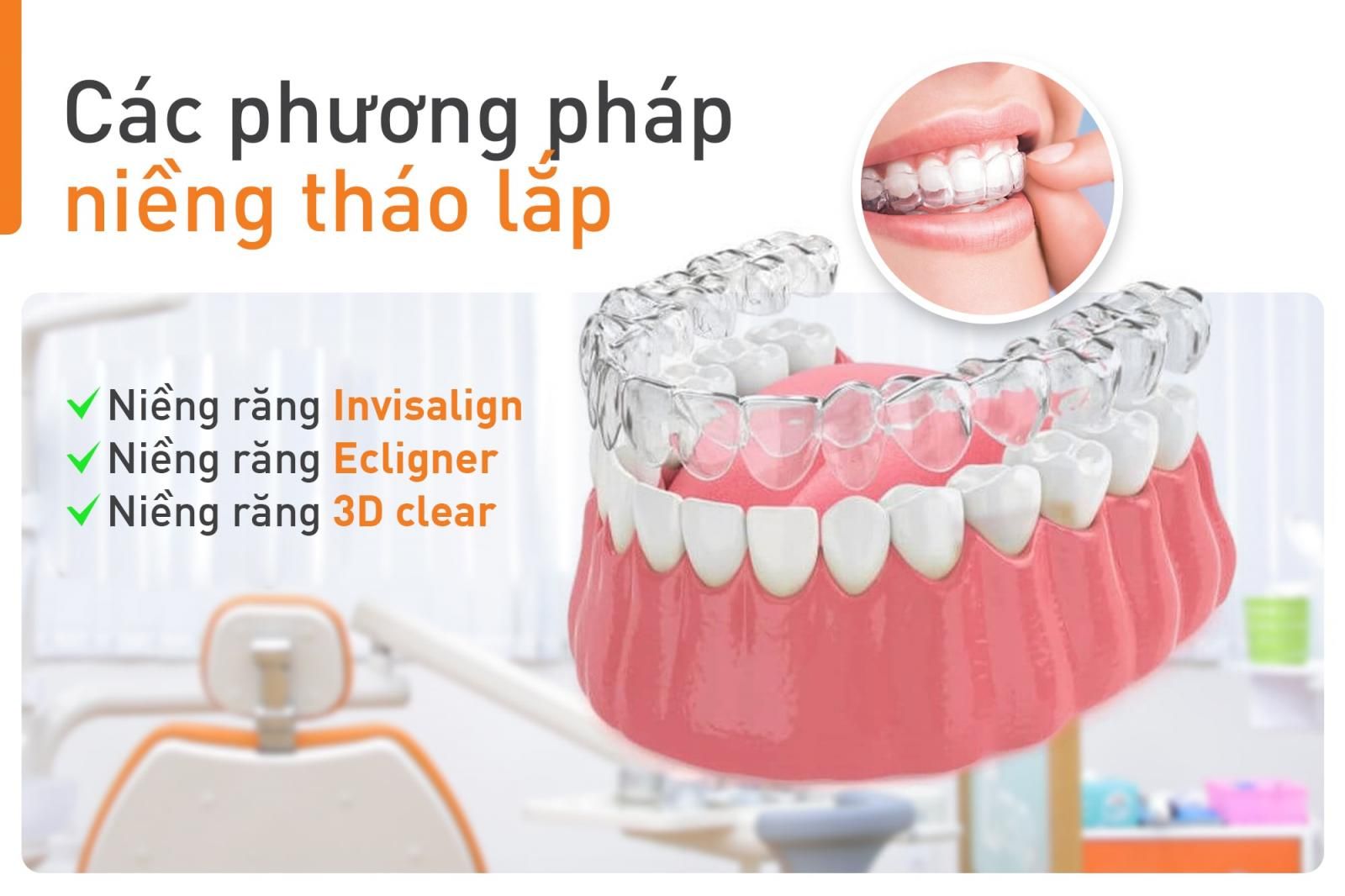 các phương pháp niềng tháo lắp