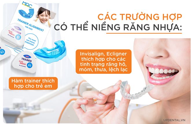 các trường hợp niềng răng nhựa