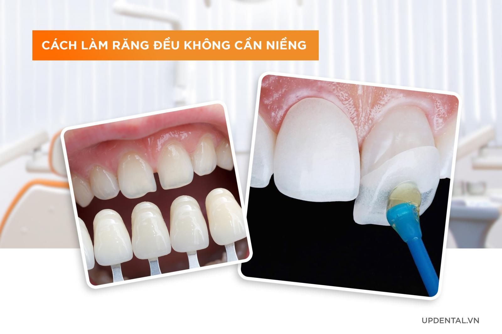 Cách làm đều răng không cần niềng