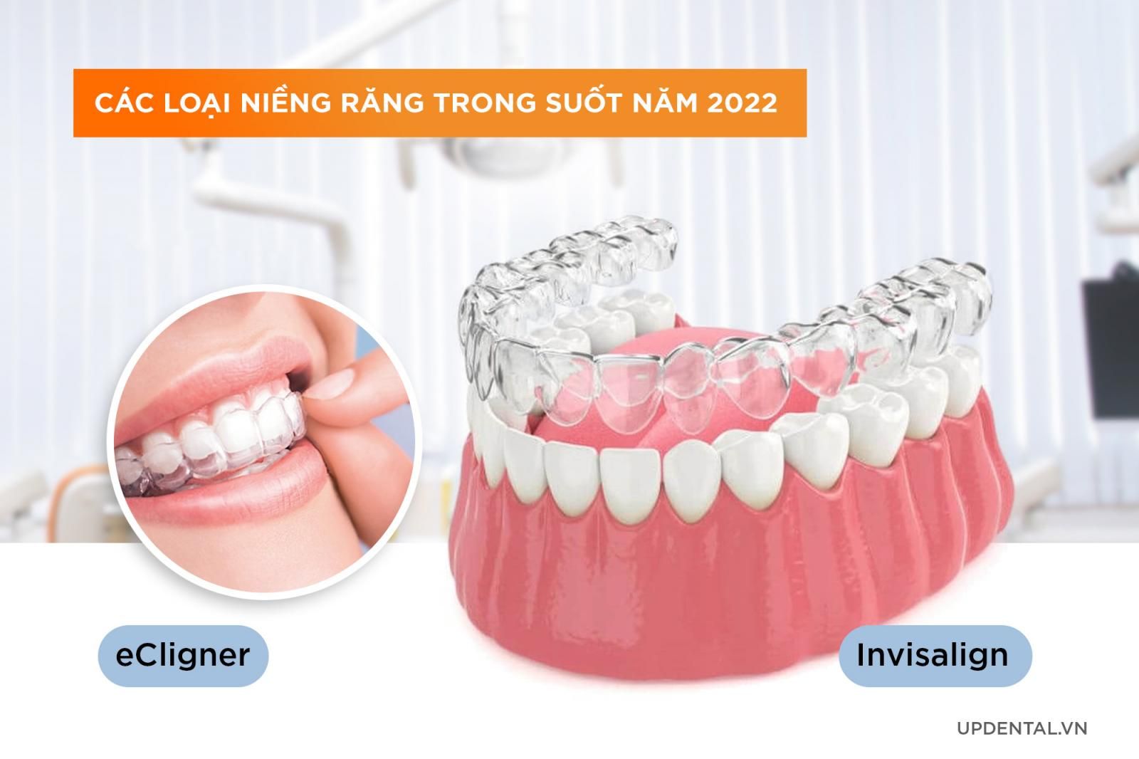 Các loại niềng răng trong suốt