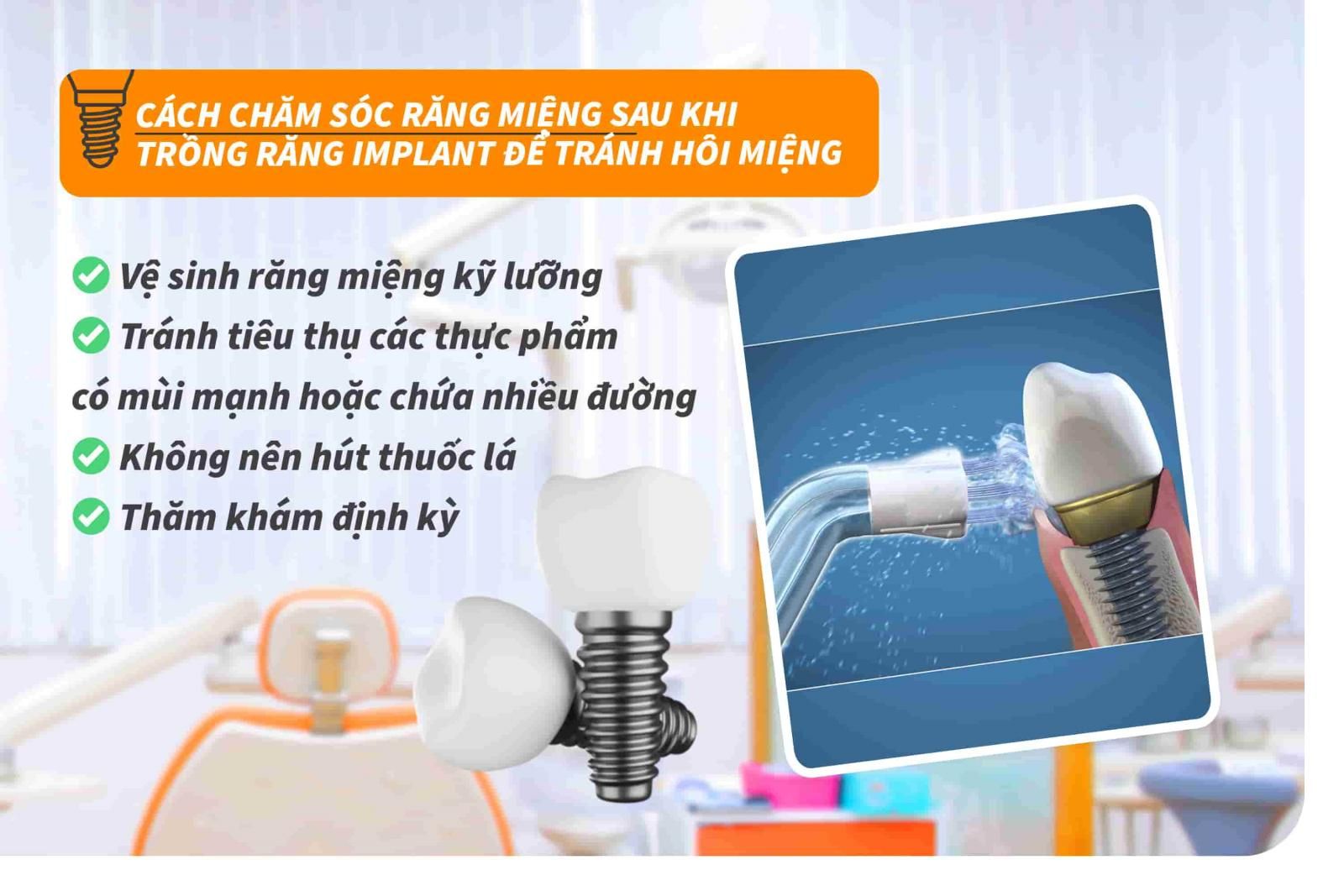 Cách chăm sóc răng miệng sau khi trồng răng Implant để tránh hôi miệng