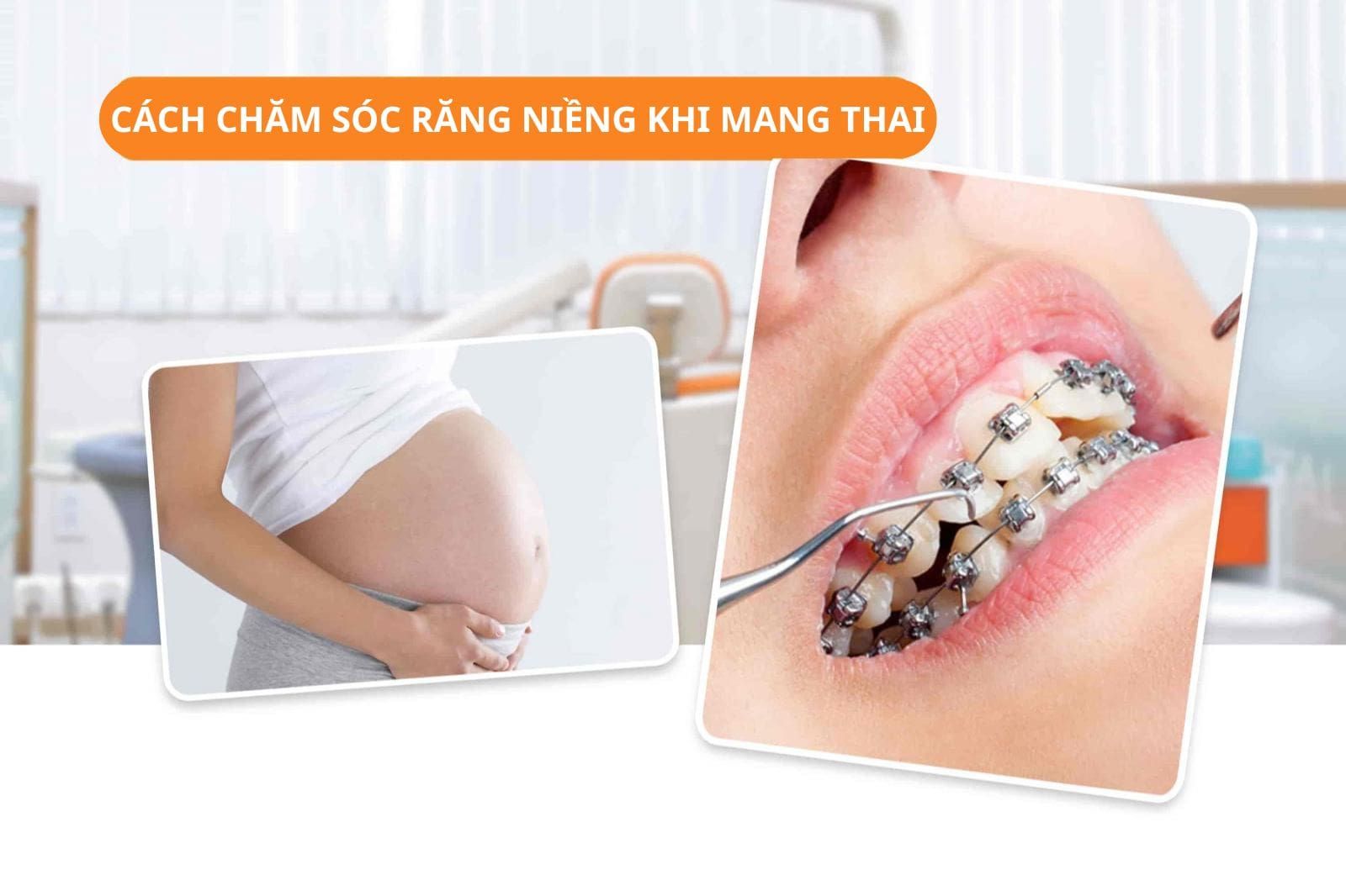 Cách chăm sóc răng niềng khi mang thai