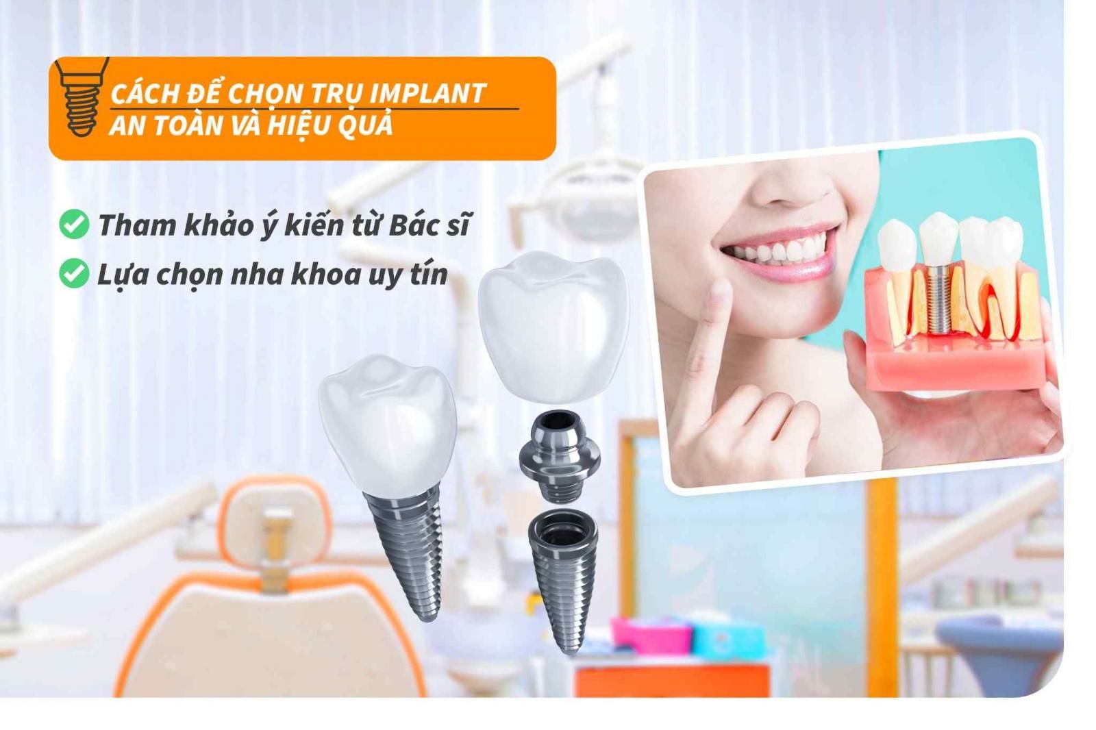 Cách để chọn trụ Implant an toàn và hiệu quả