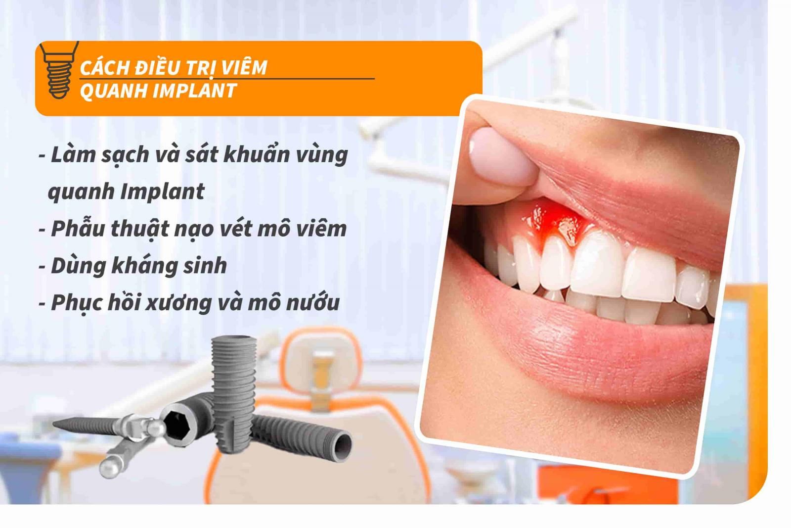 Cách điều trị viêm quanh Implant