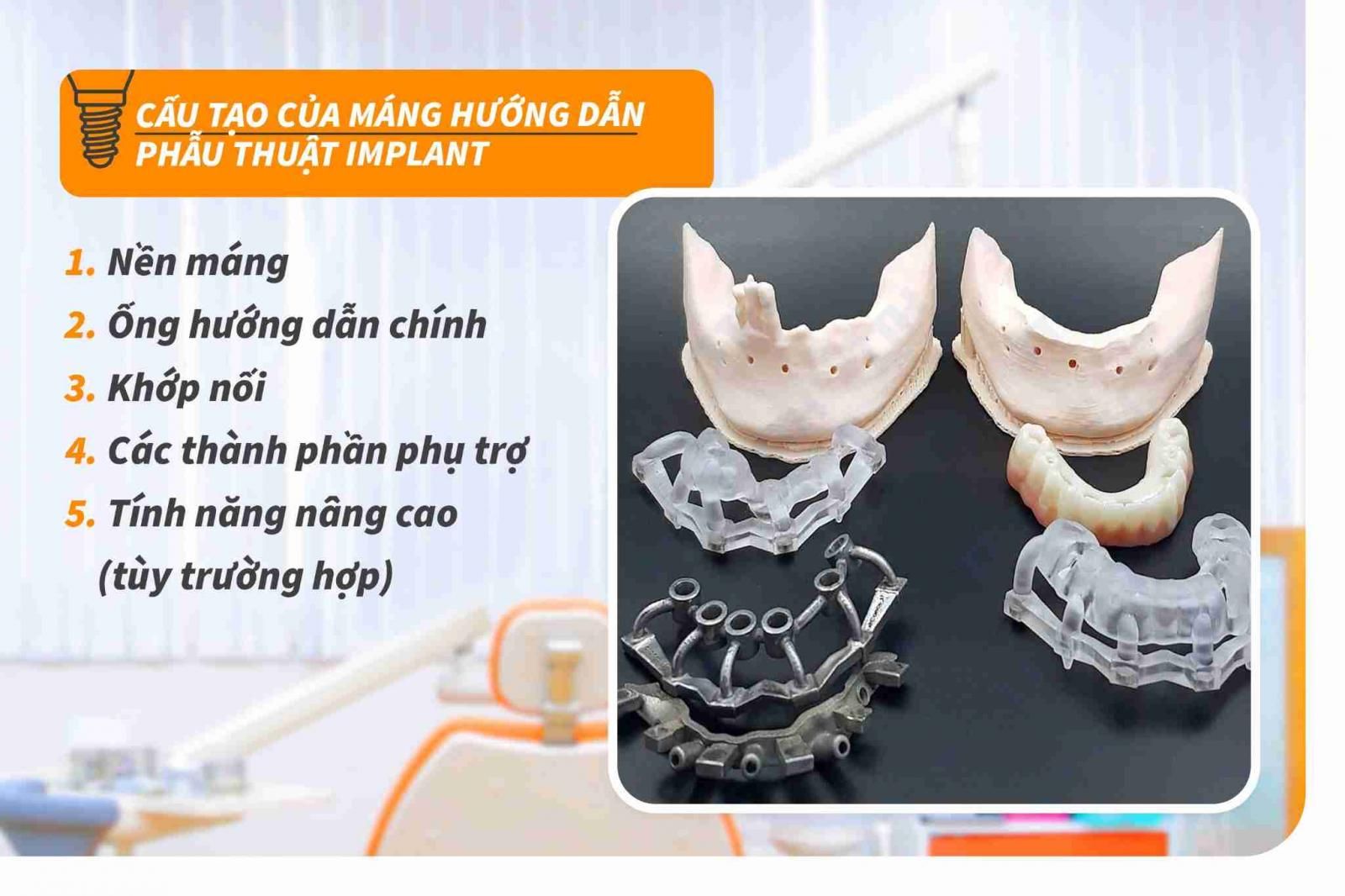 Cấu tạo của máng hướng dẫn phẫu thuật Implant  