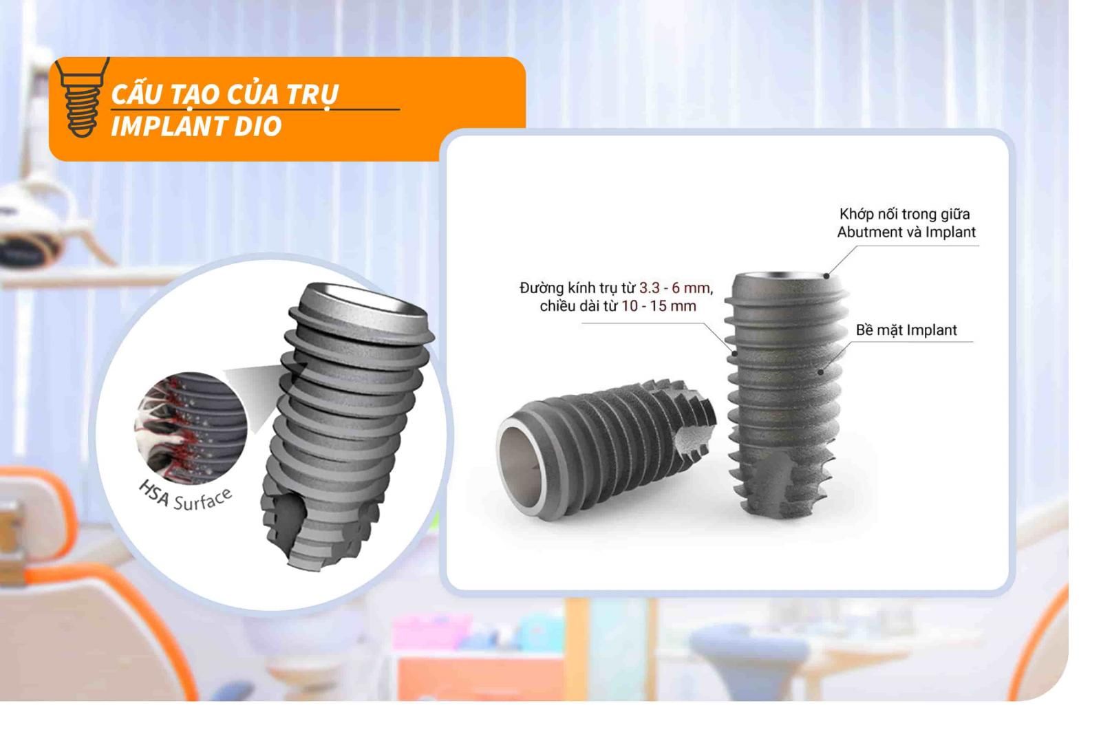 Trụ Implant Dio có cấu tạo như thế nào