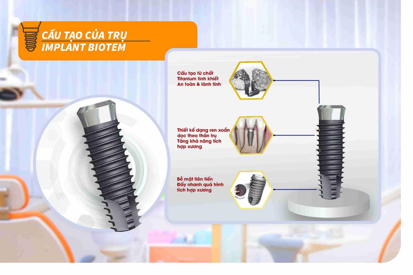 Cấu tạo của trụ Implant Biotem