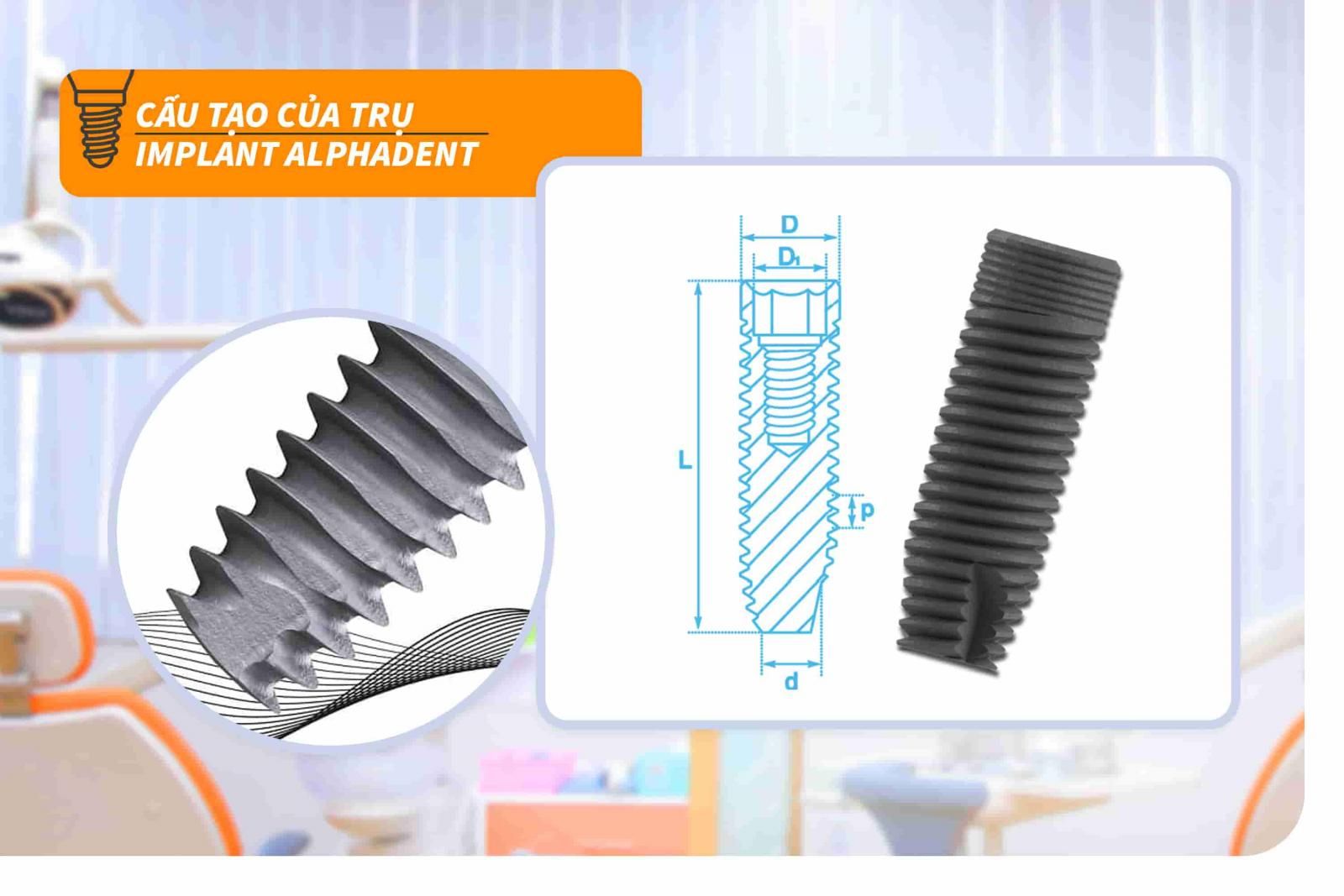 Cấu tạo của trụ Implant Alphadent