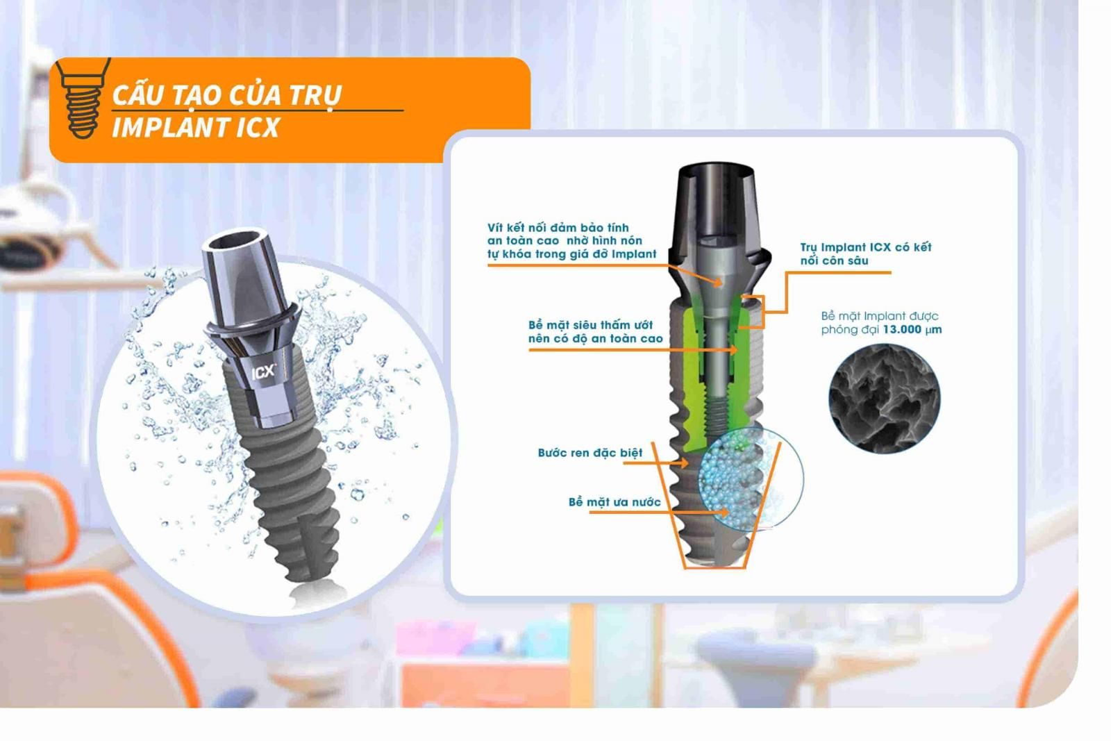 Cấu tạo của trụ Implant ICX