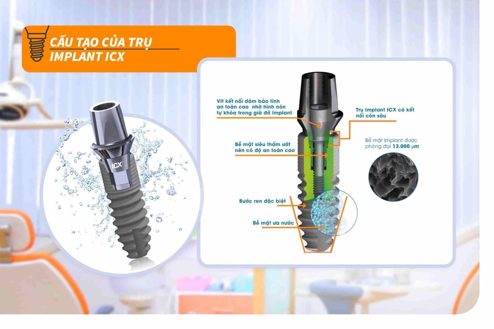 Trụ Implant ICX