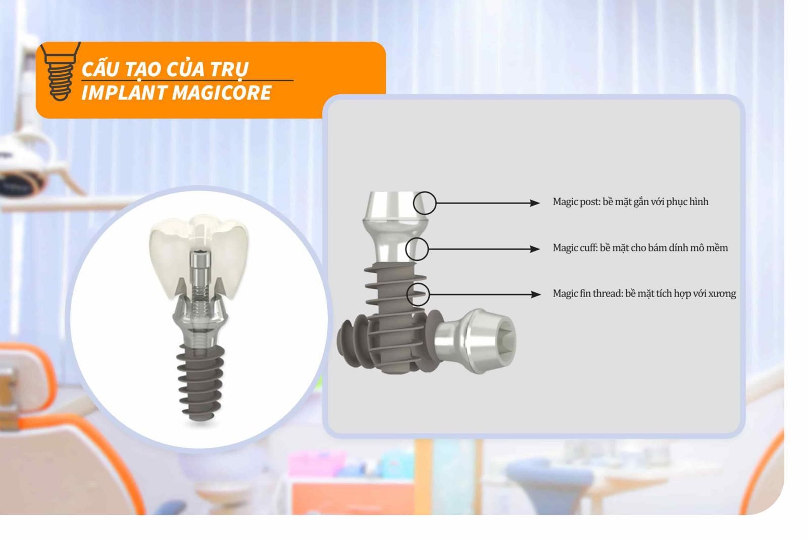 Trụ Implant MagiCore