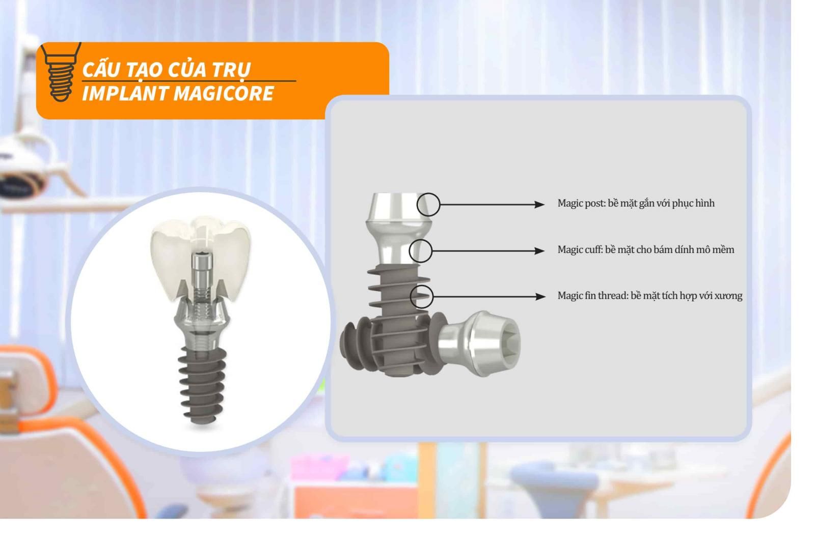 Cấu tạo của trụ Implant Magicore