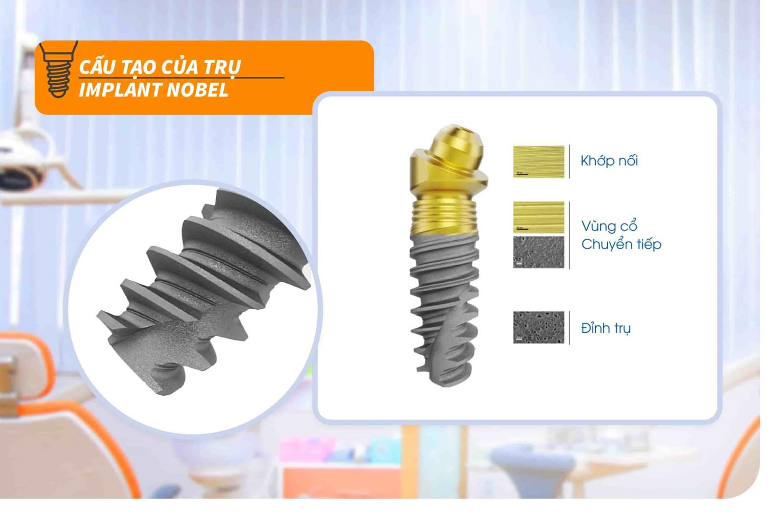 Trụ Implant Nobel có cấu tạo như thế nào?