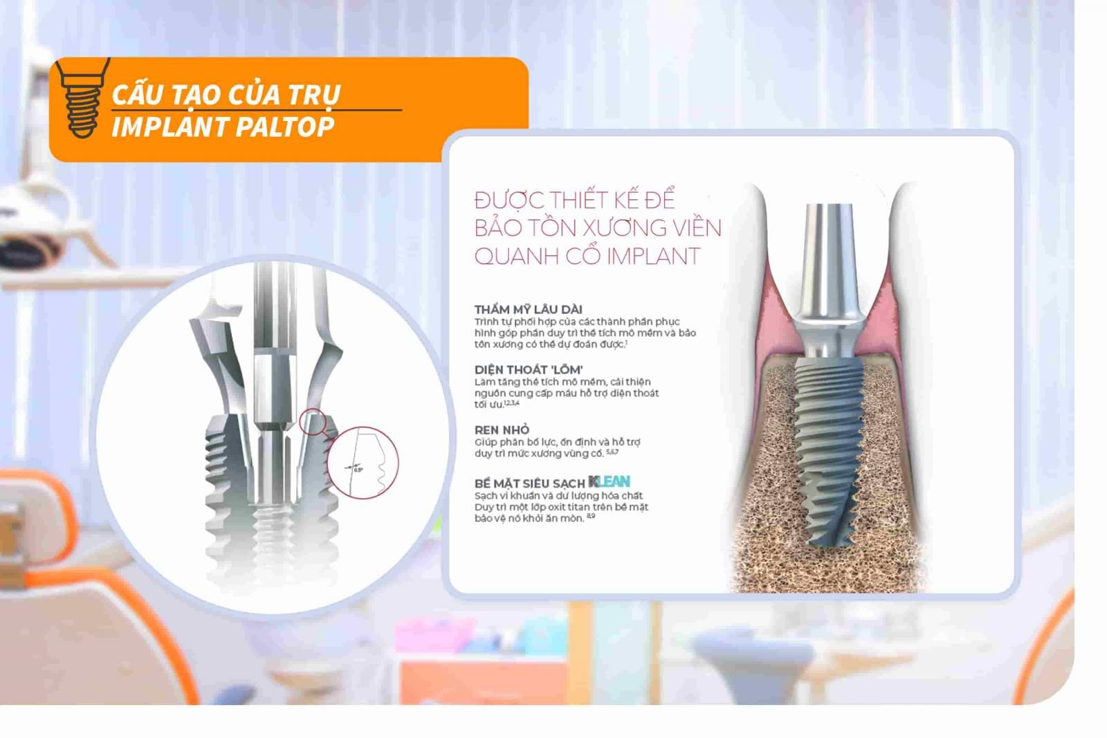 Cấu tạo của trụ Implant Paltop