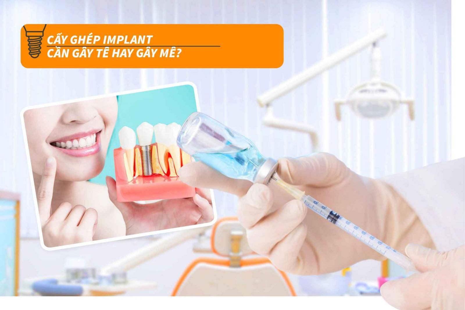 Cấy ghép Implant cần gây tê hay gây mê?