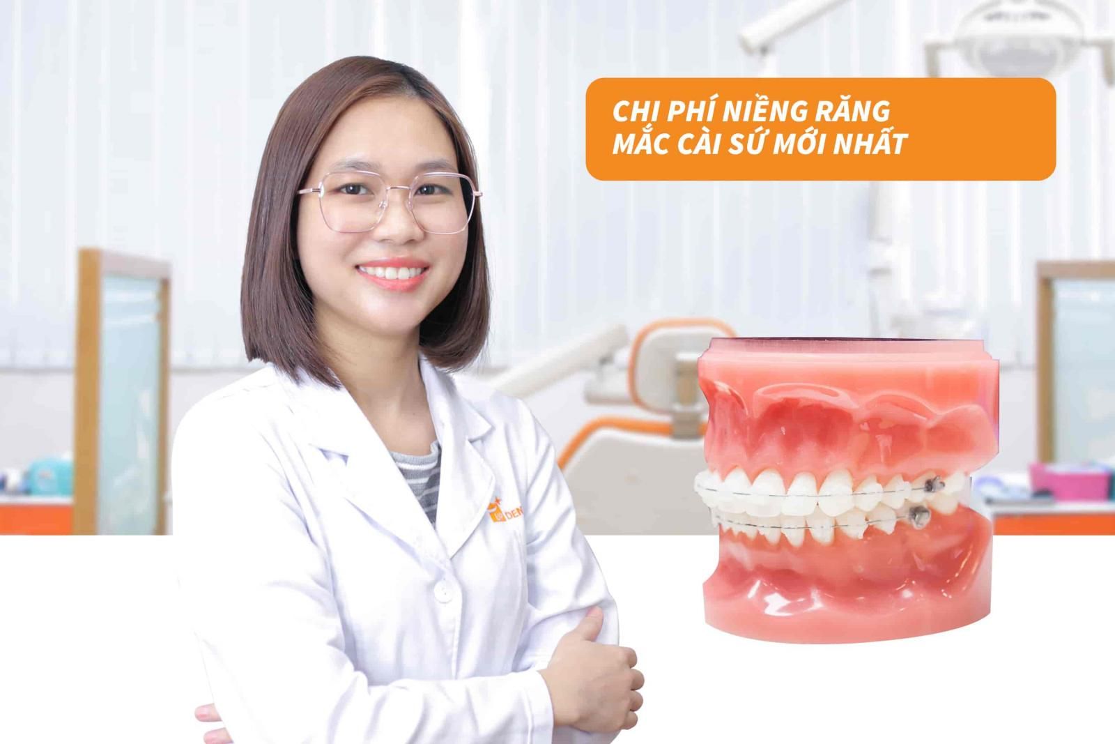 Chi phí niềng răng mắc cài sứ mới nhất