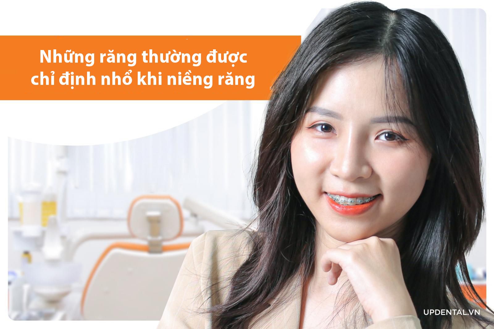 Những răng thường được chỉ định nhổ