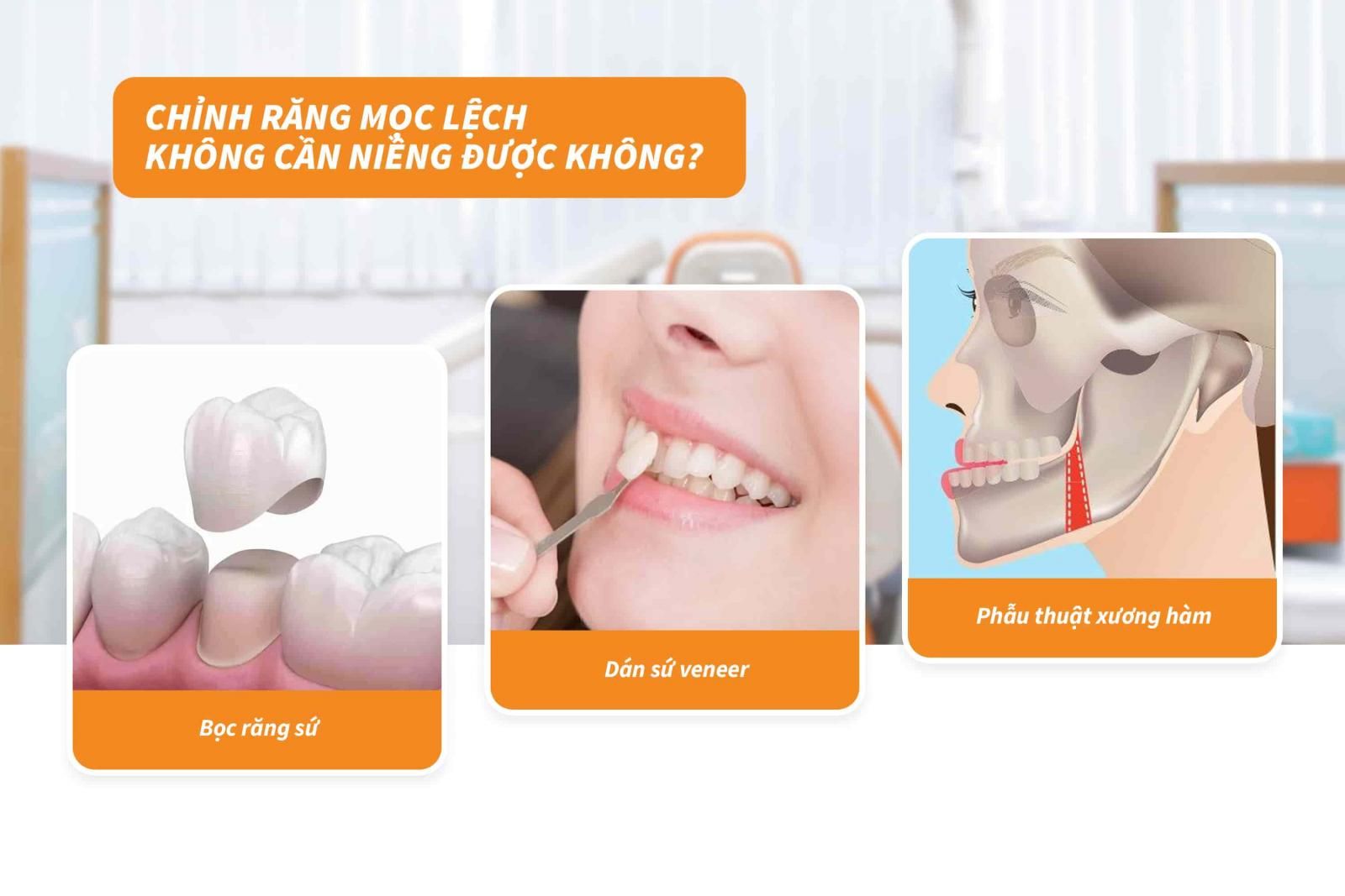 Chỉnh răng mọc lệch không cần niềng được không?