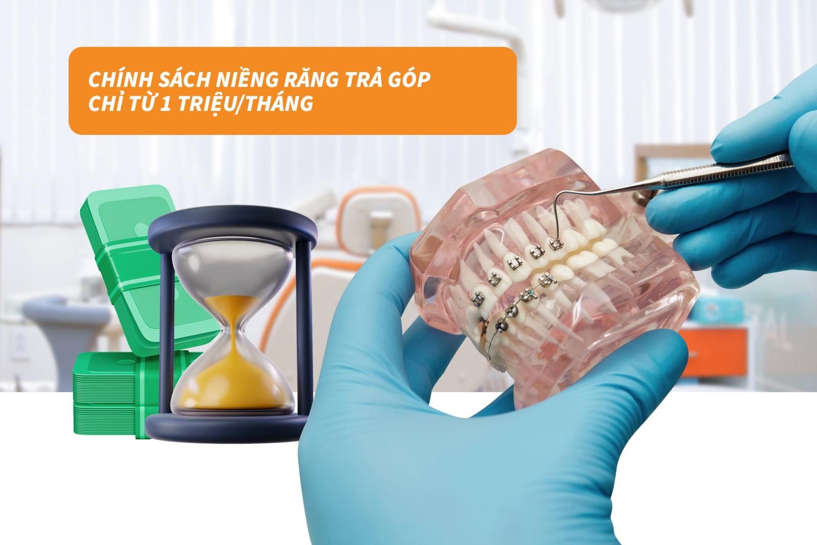 Chính sách niềng răng trả góp chỉ từ 1 triệu 1 tháng