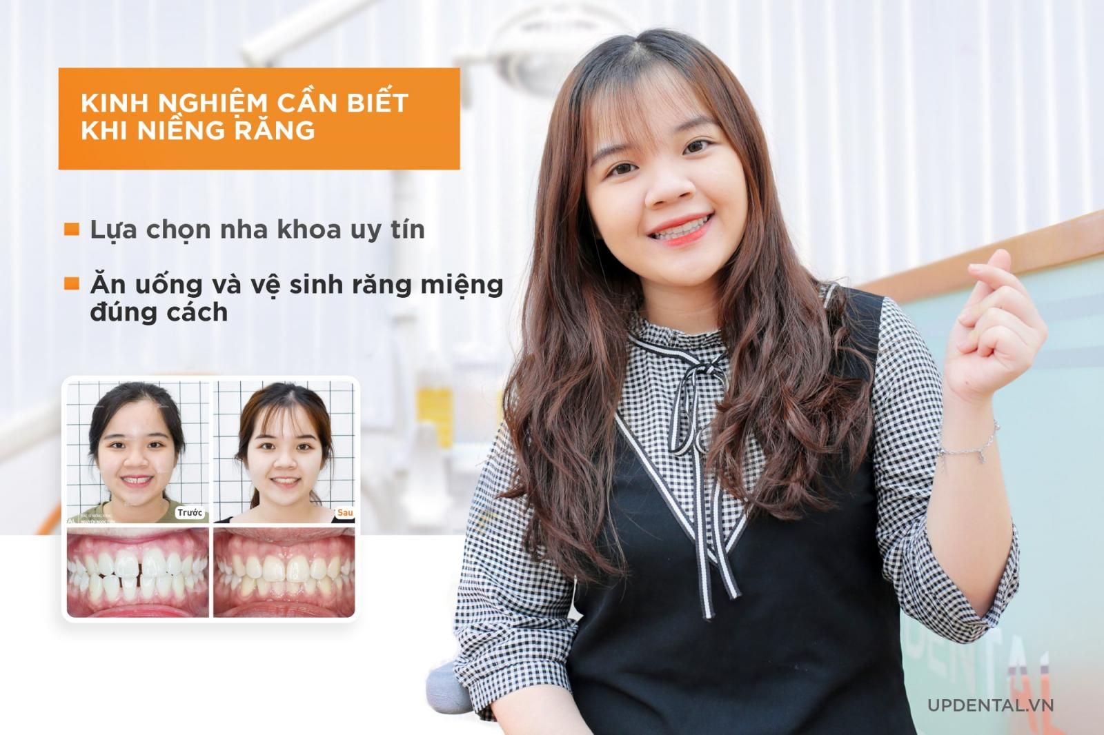 kinh nghiệm cần biết khi niềng răng