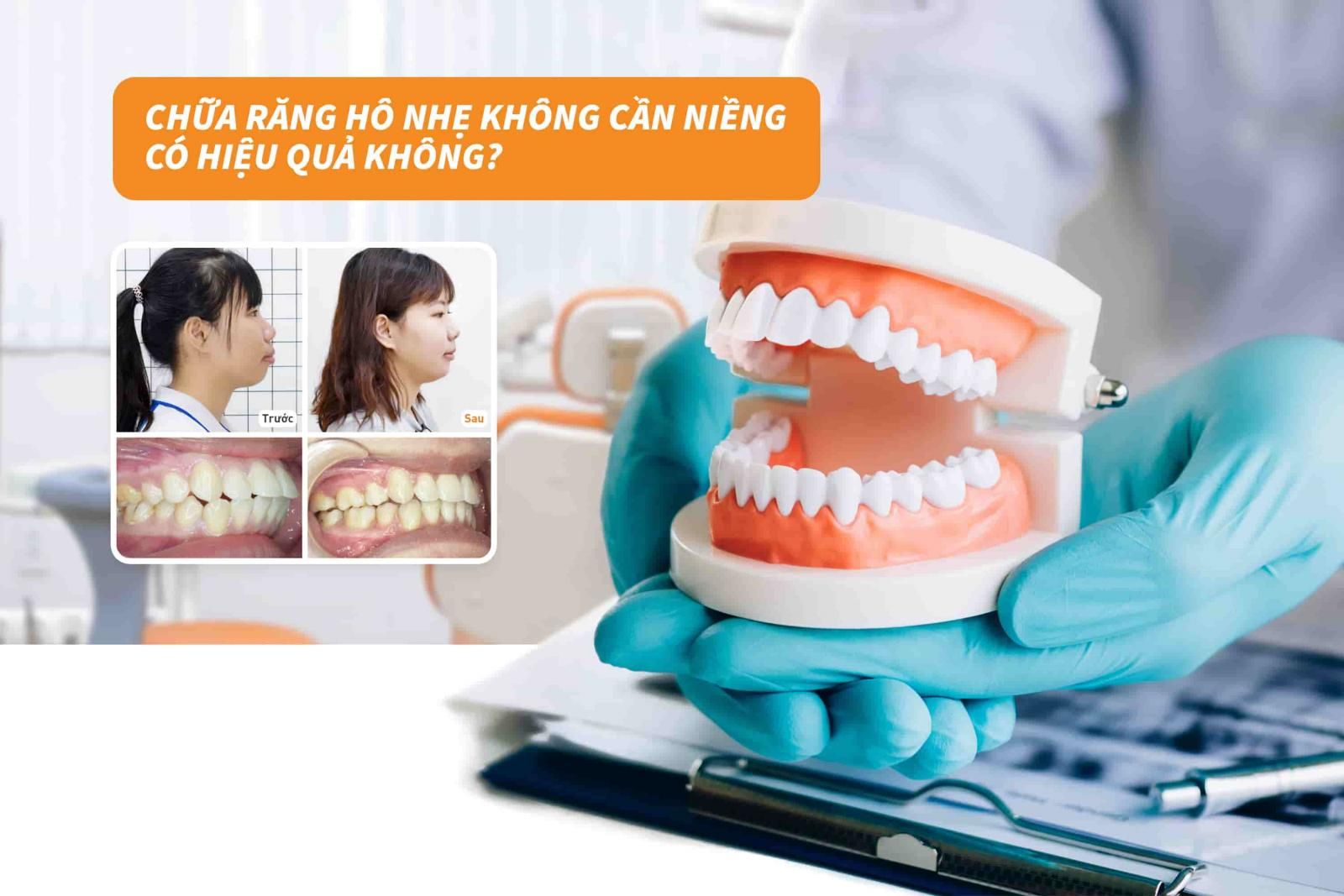 Chữa răng hô nhẹ không cần niềng có hiệu quả không? 