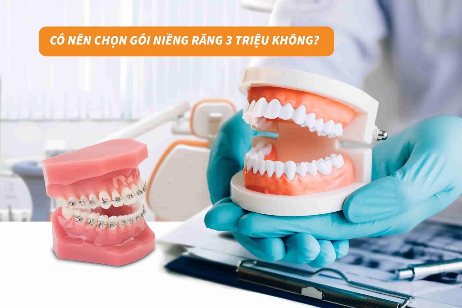 Có nên chọn niềng răng 3 triệu không?