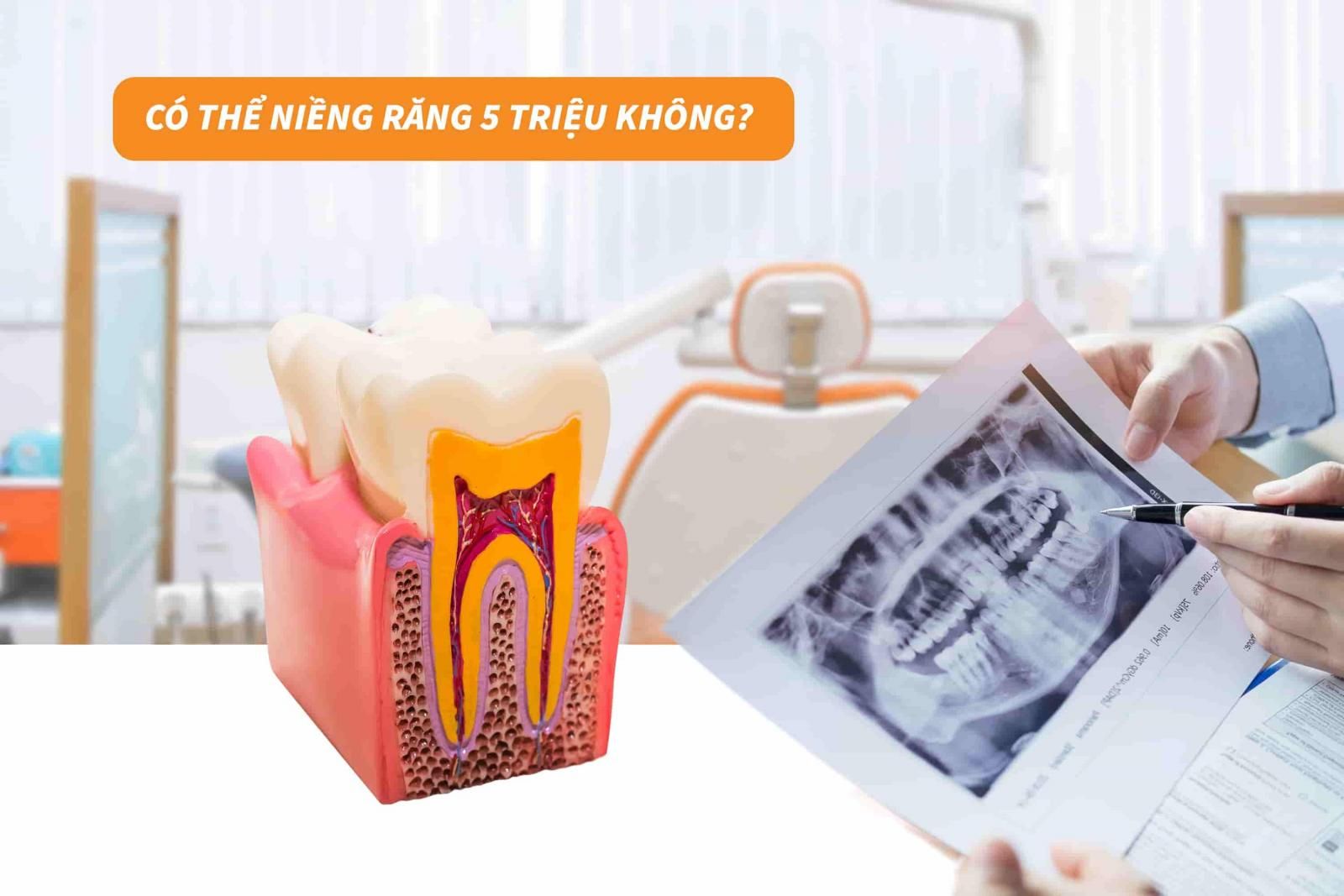 Có thể niềng răng 5 triệu không?