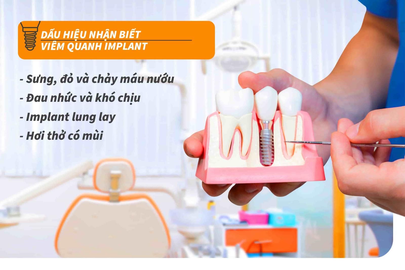 Dấu hiệu nhận biết viêm quanh Implant